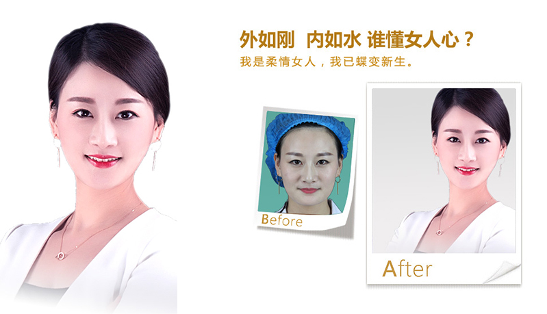 威海V脸、线雕隆鼻
